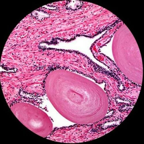 AmScope 25pc Prepared Glass Microscope Slides in Plastic Case with Plant, Fungus, Insect and Mammal Specimens