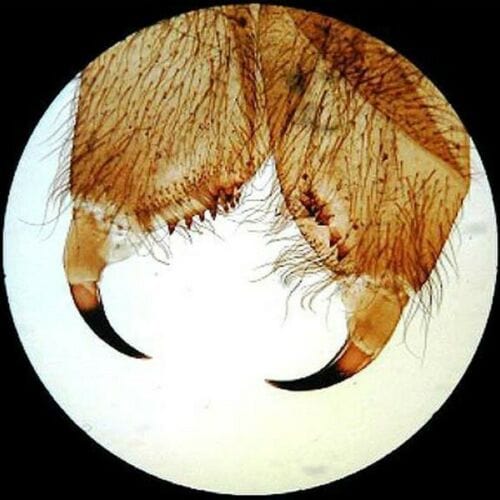 AmScope 25pc Prepared Glass Microscope Slides in Plastic Case with Plant, Fungus, Insect and Mammal Specimens