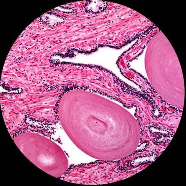 AmScope T580 Series Biological Research Grade Simul-Focal Trinocular Compound Microscope 40X-2000X Magnification with 20W Halogen, 3D Mechanical Stage