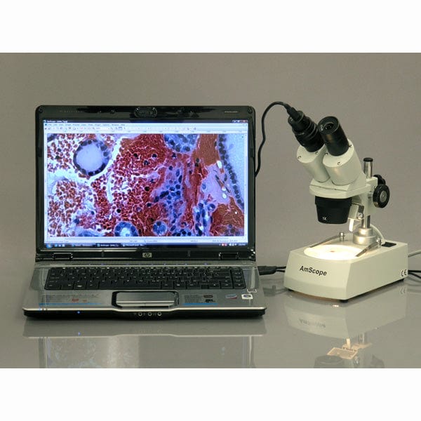 AmScope SE306 Series Compact Multi-Lens Binocular Stereo Microscope 20X-40X Magnification with Angled Head, Metal Pillar Stand, Top & Bottom Halogen Lighting, 1MP Digital Eyepiece Camera